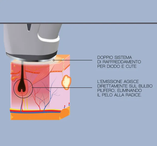 laser manipolo 1 - LASER SYSTEM 808